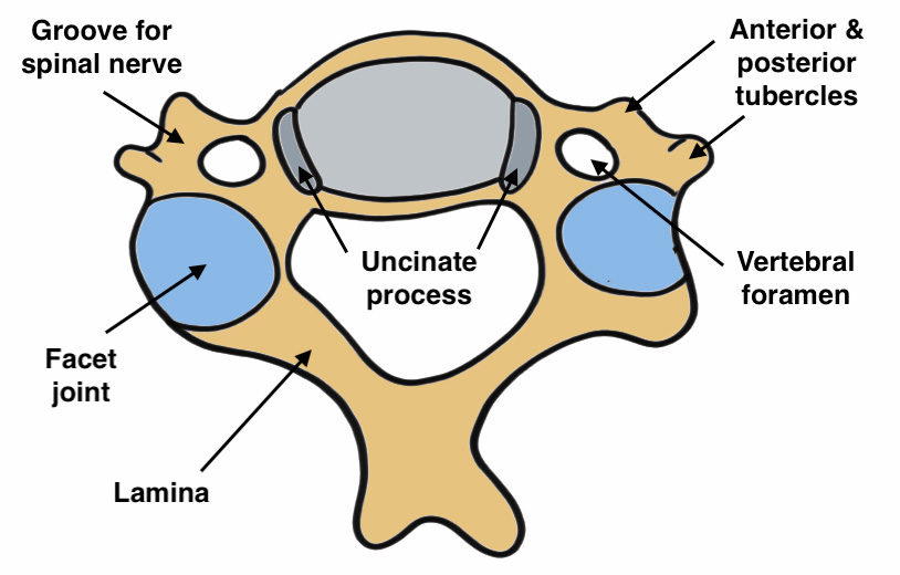 Cervical Radiculopathy | The Bone School